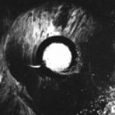 Torru Gale - Dony Arco