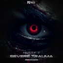 Nutty T - Severe Trauma (The Fallen Remix)
